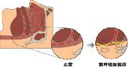 無呼吸症候群のリスク