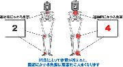 関節痛のリスク