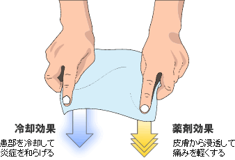 筋肉痛にバファリンなどの鎮痛剤は有効です 